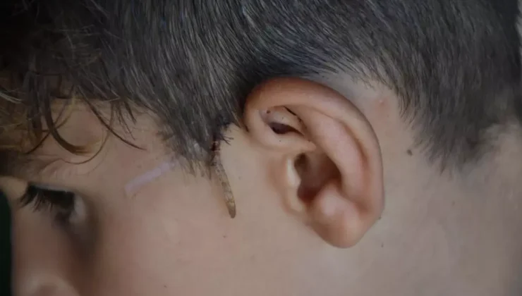 Sokak Köpeği Saldırısında Ucuza Kurtuldular