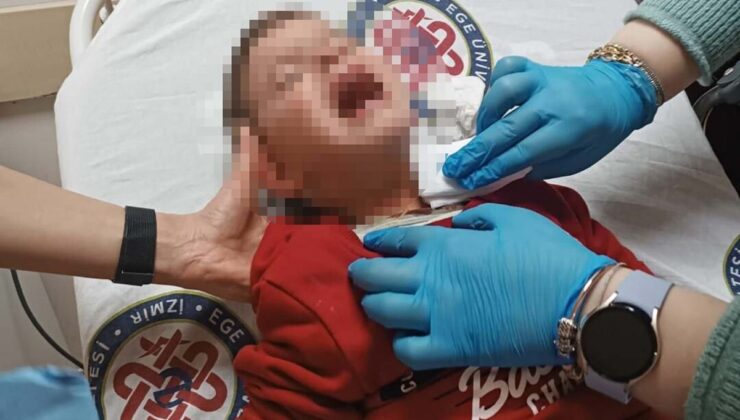 Parkta dehşet anları: 2 yaşındaki çocuk yaralandı!