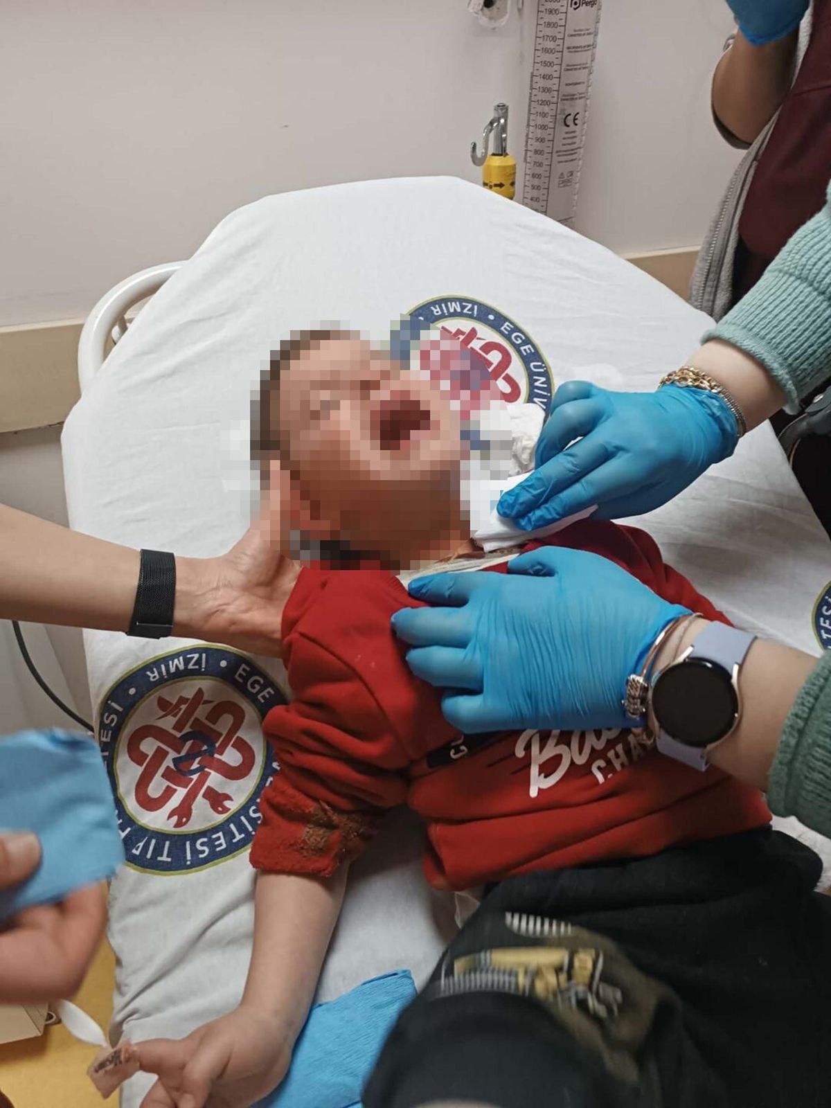 Parkta dehşet anları: 2 yaşındaki çocuk yaralandı!